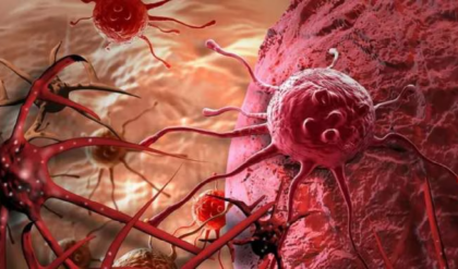 ক্যান্সারের থাবা থেকে বাঁচতে চান? প্রাথমিক এই লক্ষণগুলো অবহেলা করলেই হতে পারে চরম বিপদ!