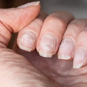 নখ কি বারবার ভেঙে যাচ্ছে? এই ৫টি ঘরোয়া টোটকায় নখ হবে হিরের মতো শক্ত!