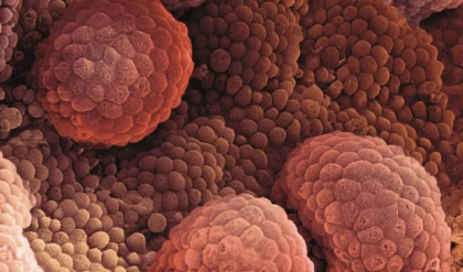 সাবধান! আপনার প্রিয় এই খাবারগুলোই ডেকে আনছে প্রস্টেট ক্যানসার? আজই সতর্ক হোন