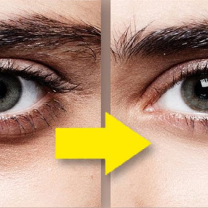 চোখের নিচে কালচে দাগ? মাত্র ৩টি সহজ উপায়ে পান উজ্জ্বল ত্বক!