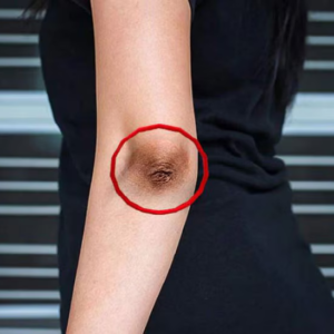 হাঁটু বা কনুইয়ের জেদি কালো দাগ? ঘরোয়া এই জাদুকরী টোটকায় ত্বক হবে উজ্জ্বল ও ফর্সা!