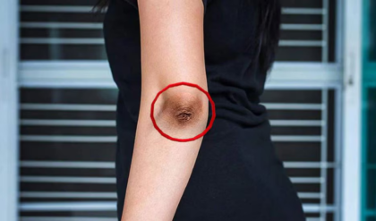 হাঁটু বা কনুইয়ের জেদি কালো দাগ? ঘরোয়া এই জাদুকরী টোটকায় ত্বক হবে উজ্জ্বল ও ফর্সা!