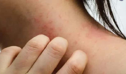 সাবান মাখলেই কি গা চুলকায়? অজান্তেই নিজের ত্বকের বারোটা বাজাচ্ছেন না তো!