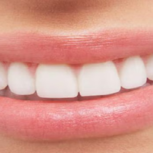 অকালেই পড়বে দাঁত! অবহেলা করলে চিকিৎসকের খরচ সামলাতে পারবেন তো? অকালেই পড়বে দাঁত! অবহেলা করলে চিকিৎসকের খরচ সামলাতে পারবেন তো?