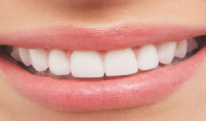 অকালেই পড়বে দাঁত! অবহেলা করলে চিকিৎসকের খরচ সামলাতে পারবেন তো? অকালেই পড়বে দাঁত! অবহেলা করলে চিকিৎসকের খরচ সামলাতে পারবেন তো?