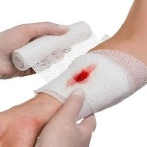 রক্তপাত বন্ধ হবে মাত্র ৩০ সেকেন্ডে! বাড়িতে কোথাও কেটে গেলে দ্রুত সুস্থ হওয়ার ঘরোয়া উপায় দেখে নিন