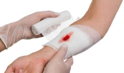 রক্তপাত বন্ধ হবে মাত্র ৩০ সেকেন্ডে! বাড়িতে কোথাও কেটে গেলে দ্রুত সুস্থ হওয়ার ঘরোয়া উপায় দেখে নিন রক্তপাত বন্ধ হবে মাত্র ৩০ সেকেন্ডে! বাড়িতে কোথাও কেটে গেলে দ্রুত সুস্থ হওয়ার ঘরোয়া উপায় দেখে নিন