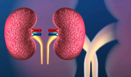 কিডনি কি ধীরে ধীরে বিকল হচ্ছে? শরীর দিচ্ছে এই ৫টি সংকেত, এখনই সতর্ক না হলে শয্যাশায়ী হতে পারেন! কিডনি কি ধীরে ধীরে বিকল হচ্ছে? শরীর দিচ্ছে এই ৫টি সংকেত, এখনই সতর্ক না হলে শয্যাশায়ী হতে পারেন!