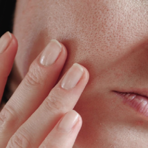 আয়নায় নিজের মুখ দেখে বিরক্ত? বড় লোমকূপ বা ওপেন পোরস ছোট করার ৫টি জাদুকরী টিপস! আয়নায় নিজের মুখ দেখে বিরক্ত? বড় লোমকূপ বা ওপেন পোরস ছোট করার ৫টি জাদুকরী টিপস!