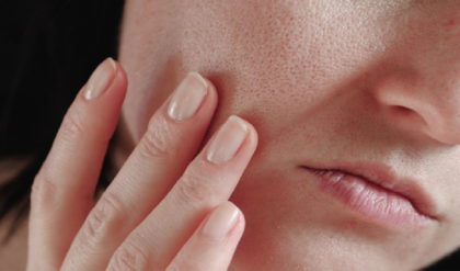 আয়নায় নিজের মুখ দেখে বিরক্ত? বড় লোমকূপ বা ওপেন পোরস ছোট করার ৫টি জাদুকরী টিপস!