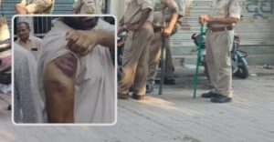 গোরখপুরে পুলিশি তাণ্ডব! থানায় তুলে নিয়ে তিন যুবককে অকথ্য নির্যাতন,