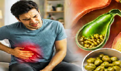 পিত্তথলিতে পাথর হওয়ার ঝুঁকি বাড়াচ্ছে আপনার পছন্দের এই ৪ খাবার! আজই সাবধান হোন